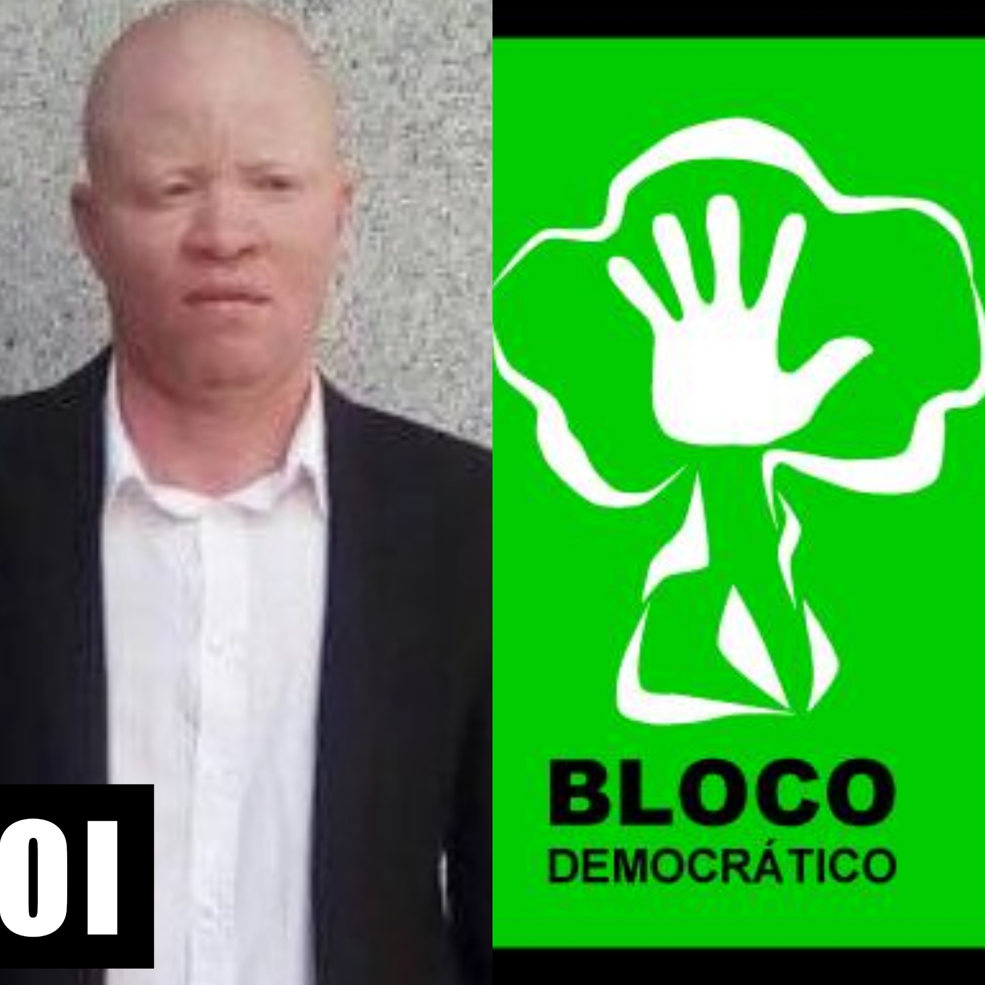 “Para além de ter sido espancado por polícias e militares, também fui vítima de abusos por ser albino”, diz secretário do BD no Kuanza-Sul